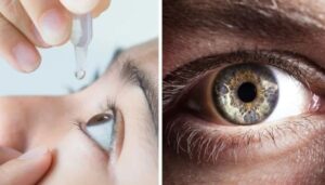 giảm cận thị 1-2 độ không cần phẫu thuật