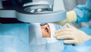 tác hại của việc mổ mắt cận thị