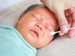 ve sinh cho tinh trang tac tuyen le o tre