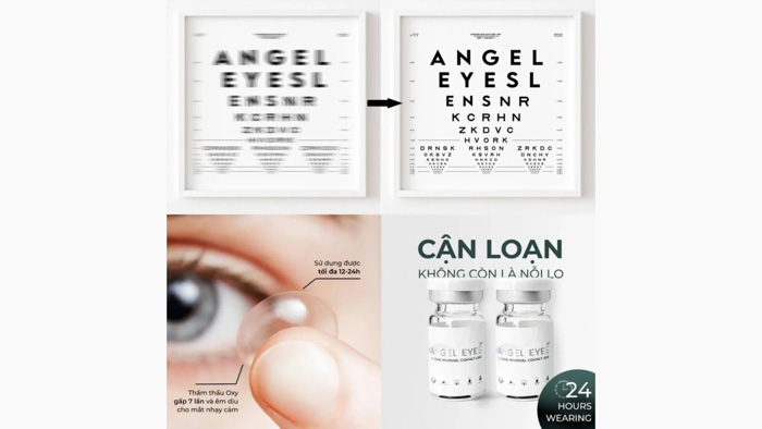 Cách Chọn Lens Cho Mắt Cận Loạn: Hướng Dẫn Từ A đến Z 1 Cách chọn lens cho mắt cận loạn