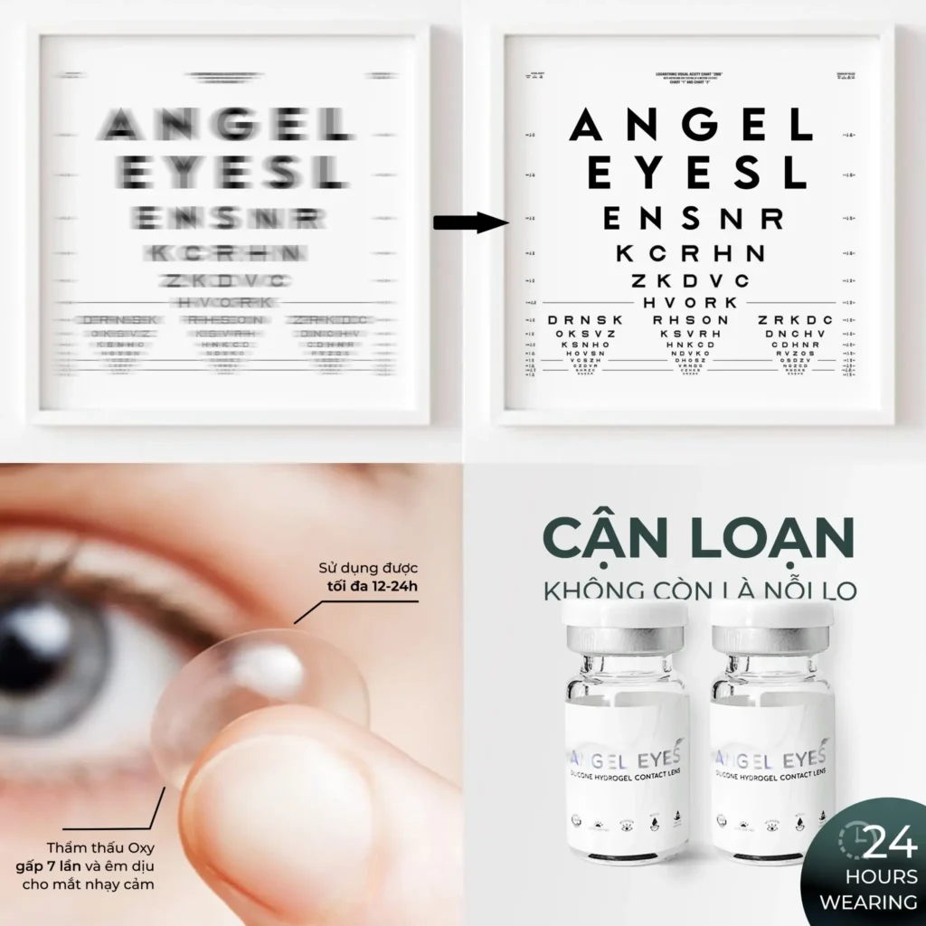 Cách Chọn Lens Cho Mắt Cận Loạn: Hướng Dẫn Từ A đến Z 1 Cách chọn lens cho mắt cận loạn