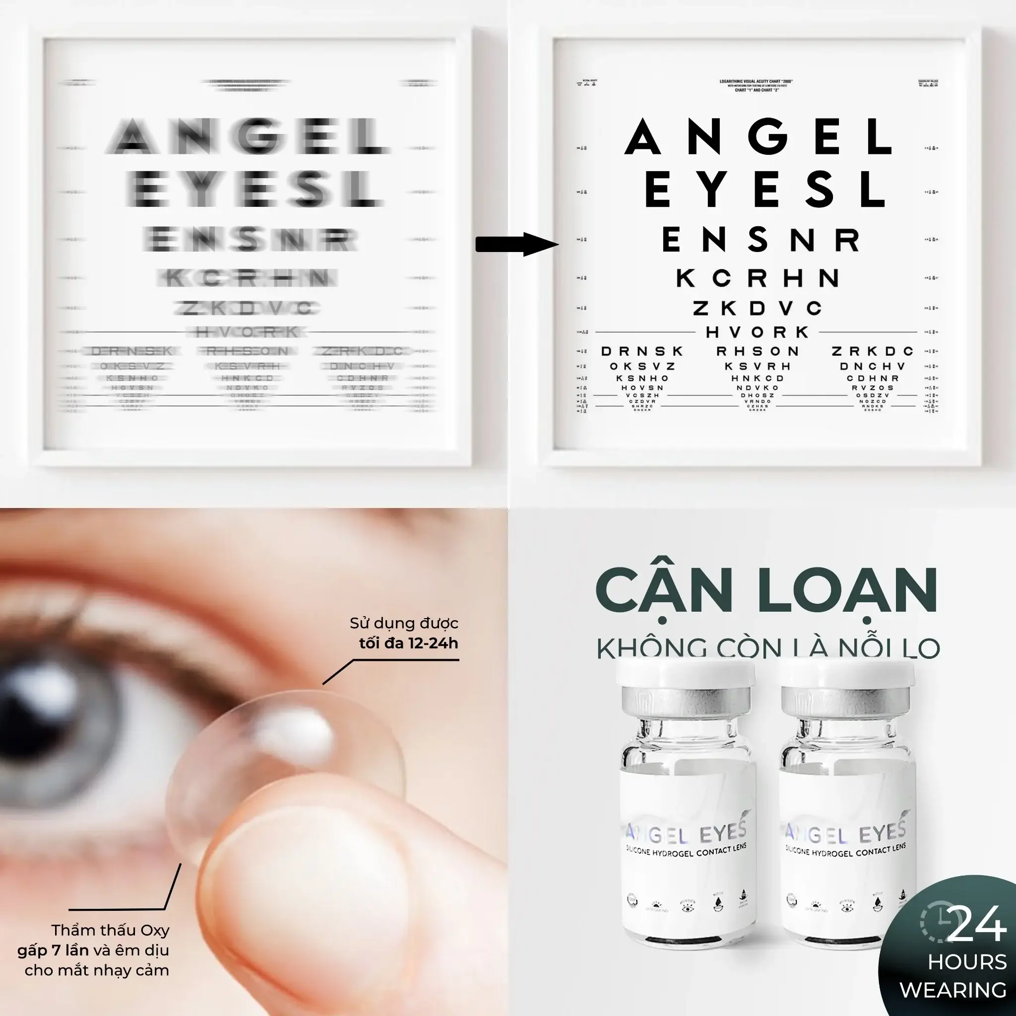 cach-chon-lens-cho-mat-can-loan