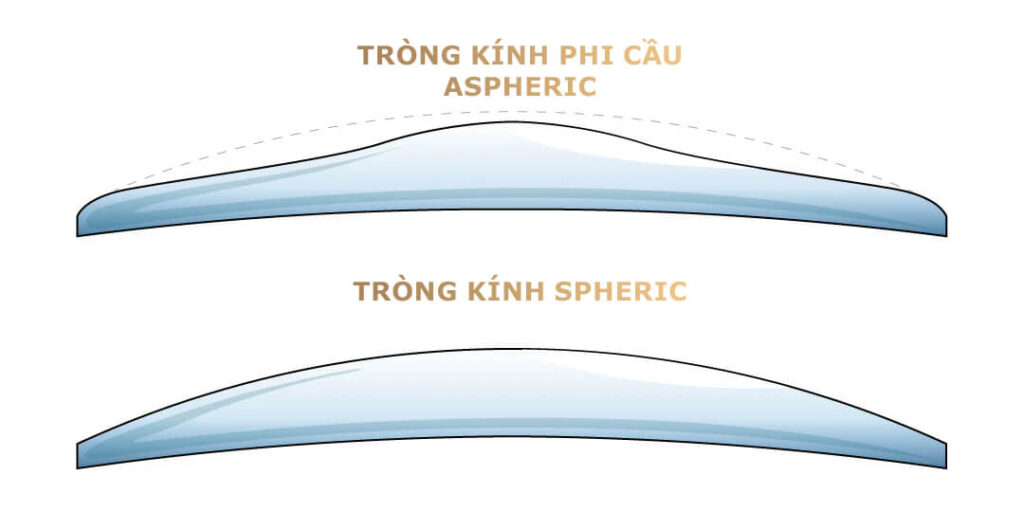 Cận 1 Bên Mắt: Nguyên Nhân Và Cách Xử Lý Không Nên Bỏ Qua 4 cận 1 bên mắt-Bị cận 1 bên mắt có nên đeo kính không?