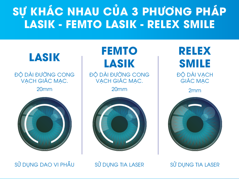 Mổ Mắt Chữa Cận Thị – Những Điều Cần Biết Trước Khi Quyết Định 3 Mổ mắt chữa cận thị -Các Phương Pháp Mổ Mắt Cận Thị Được Ứng Dụng Hiện Nay