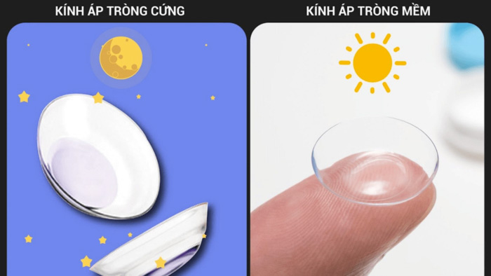 Kính áp tròng cận thị – Giải pháp thay thế kính gọng 4 Kính áp tròng cận thị cứng và mềm